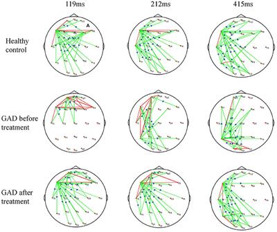 Repetitive Transcranial Magnetic Stimulation Modulates Frontal and Temporal Time-Varying EEG Network in Generalized Anxiety Disorder: A Pilot Study